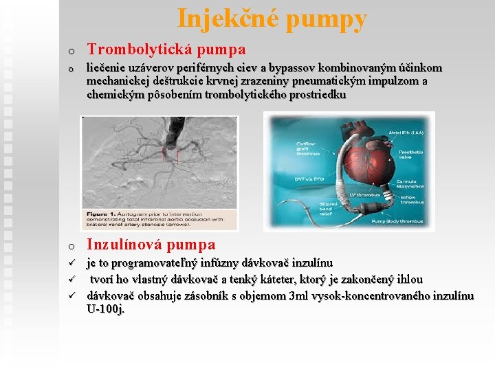 Injekčné pumpy o Trombolytická pumpa o liečenie uzáverov periférnych ciev a bypassov kombinovaným účinkom