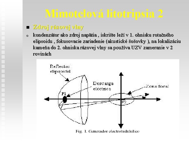 Mimotelová litotripsia 2 n Zdroj rázovej vlny o kondenzátor ako zdroj napätia , iskrište