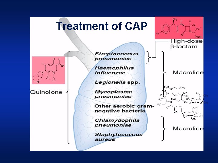 Treatment of CAP 