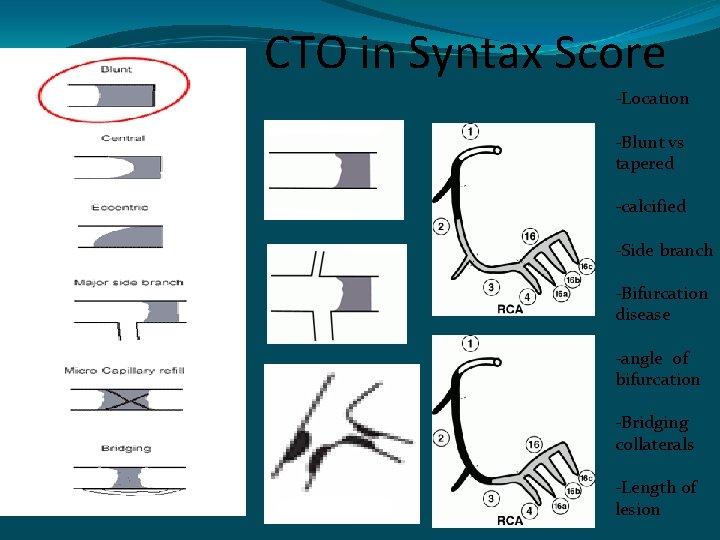 CTO in Syntax Score -Location -Blunt vs tapered -calcified -Side branch -Bifurcation disease -angle