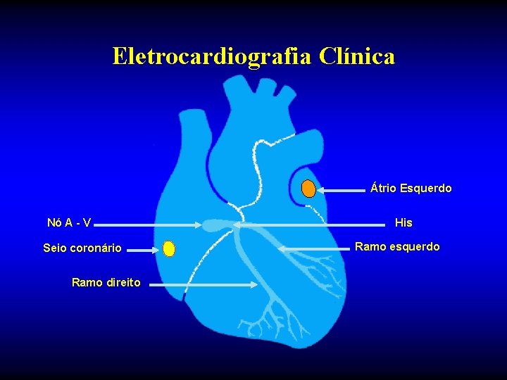 Eletrocardiografia Clínica Átrio Esquerdo Nó A - V Seio coronário Ramo direito His Ramo