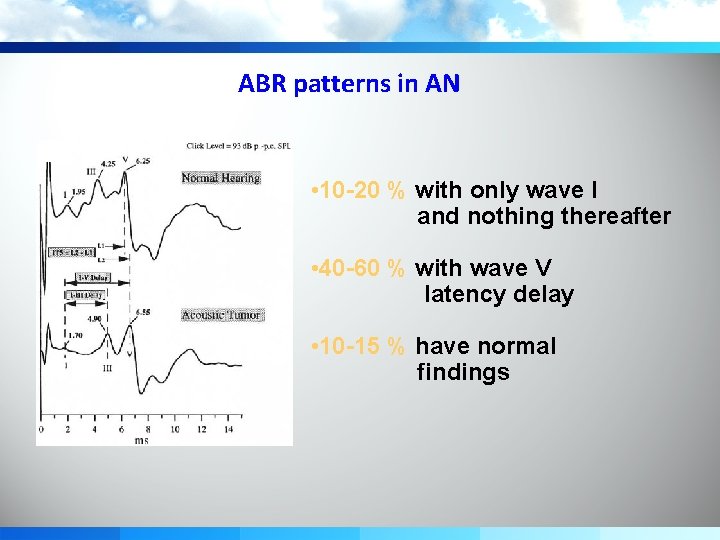 ABR patterns in AN • 10 -20 % with only wave I and nothing