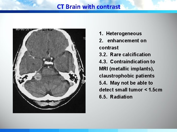 CT Brain with contrast 1. Heterogeneous 2. enhancement on contrast 3. 2. Rare calcification