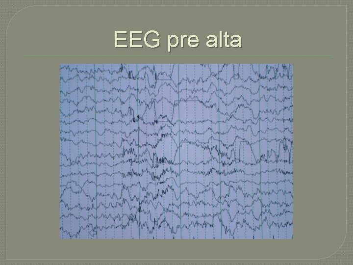 EEG pre alta EEG pre alta