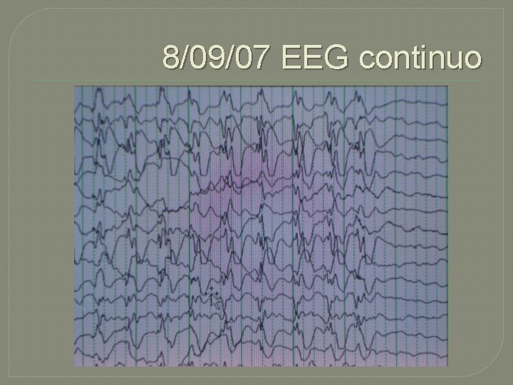 8/09/07 EEG continuo 8/09/07 EEG continuo