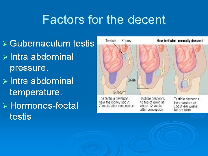 Factors for the decent Ø Gubernaculum testis Ø Intra abdominal pressure. Ø Intra abdominal
