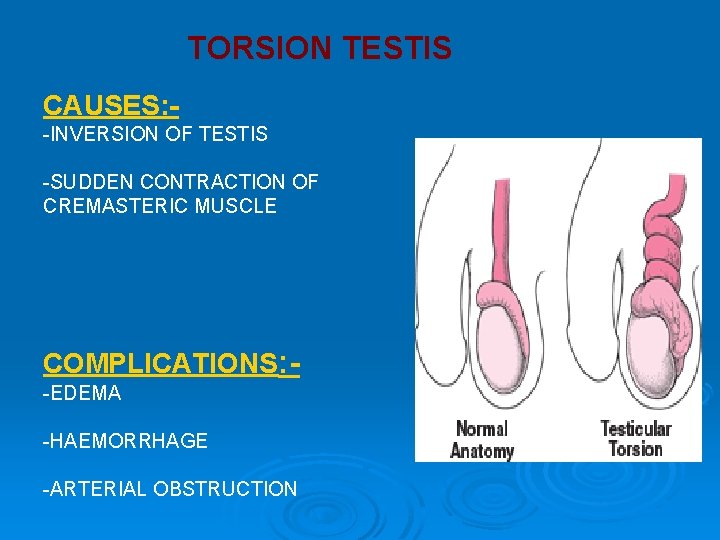 TORSION TESTIS CAUSES: -INVERSION OF TESTIS -SUDDEN CONTRACTION OF CREMASTERIC MUSCLE COMPLICATIONS: -EDEMA -HAEMORRHAGE