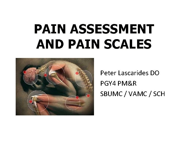 PAIN ASSESSMENT AND PAIN SCALES Peter Lascarides DO PGY 4 PM&R SBUMC / VAMC