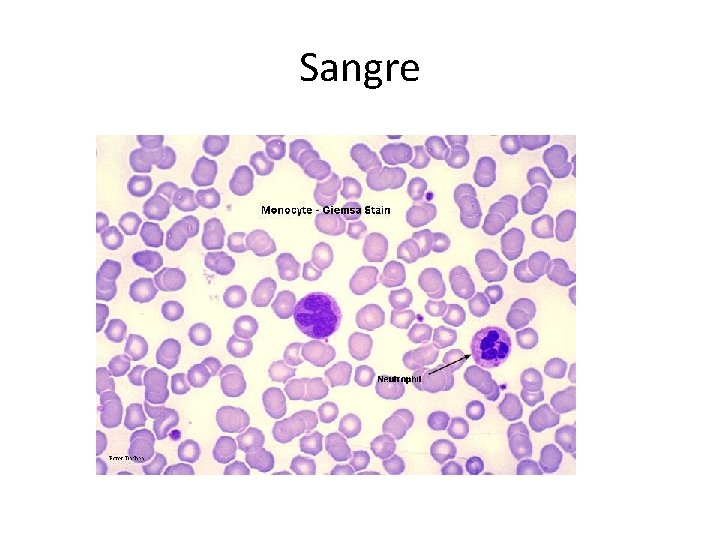 Sangre 