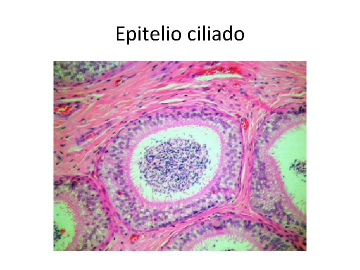 Epitelio ciliado 