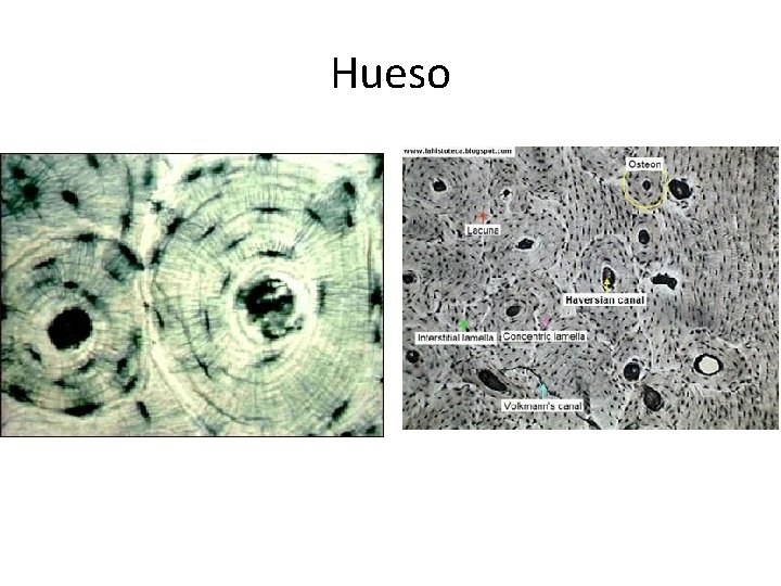 Hueso 