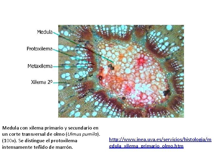 Medula con xilema primario y secundario en un corte transversal de olmo (Ulmus pumila).