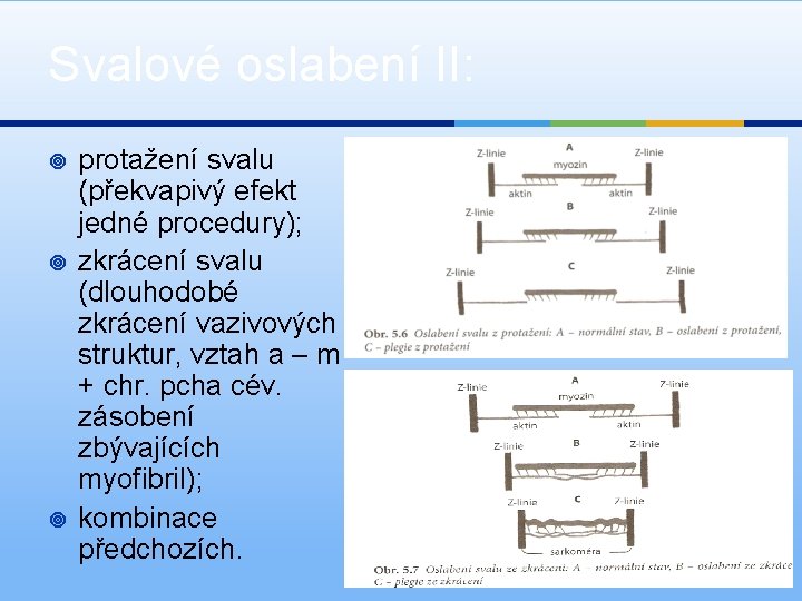 Svalové oslabení II: ¥ ¥ ¥ protažení svalu (překvapivý efekt jedné procedury); zkrácení svalu