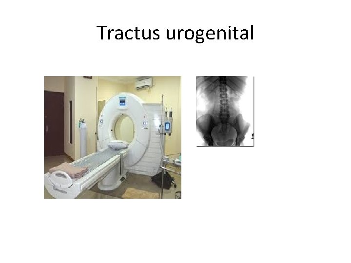 Tractus urogenital 