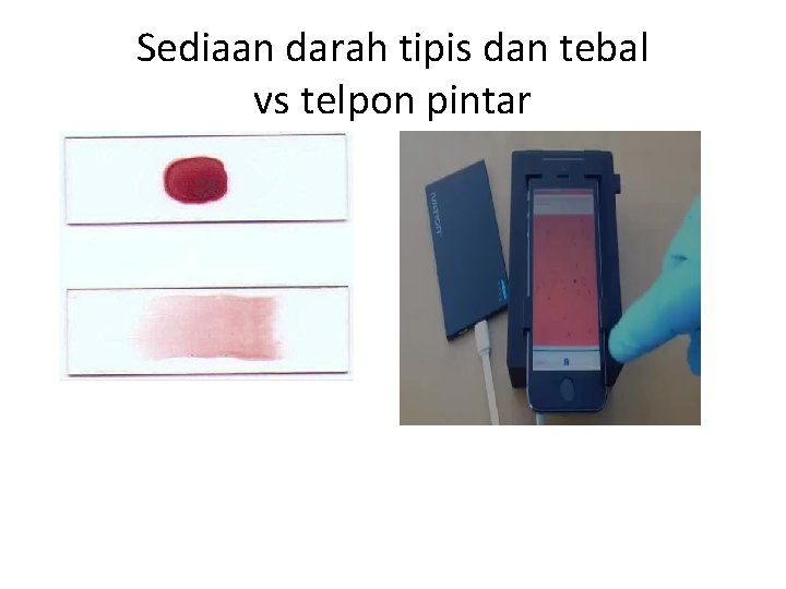 Sediaan darah tipis dan tebal vs telpon pintar 