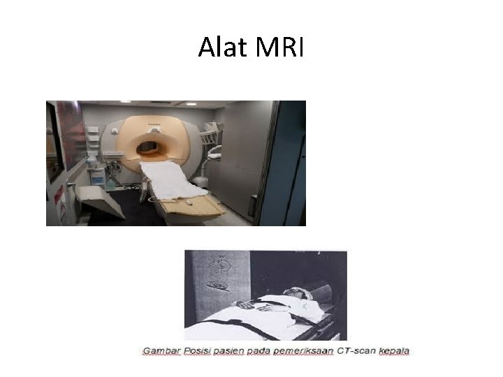 Alat MRI 