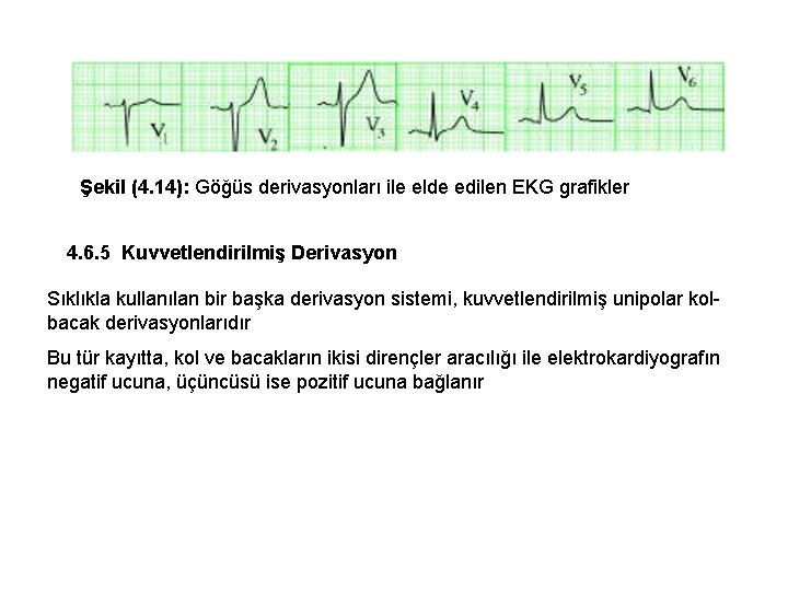 Şekil (4. 14): Göğüs derivasyonları ile elde edilen EKG grafikler 4. 6. 5 Kuvvetlendirilmiş