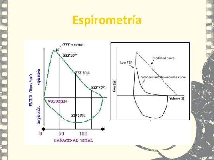 Espirometría Espirometría