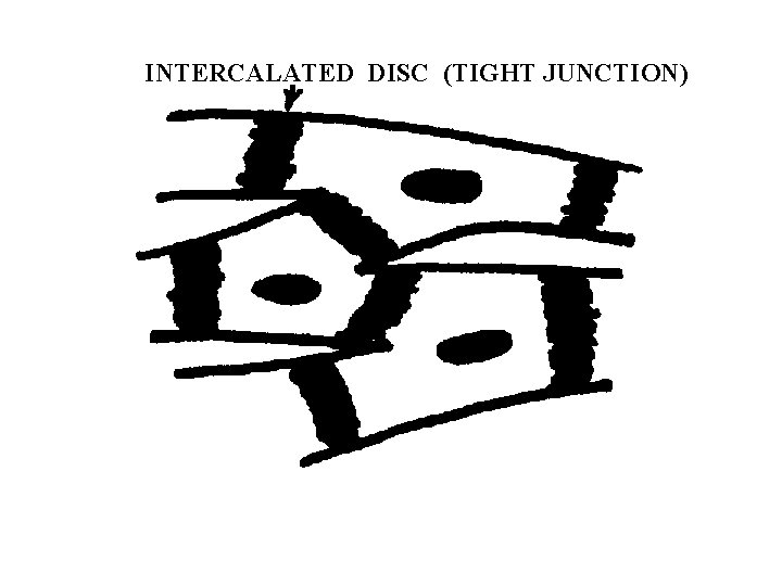 INTERCALATED DISC (TIGHT JUNCTION) 