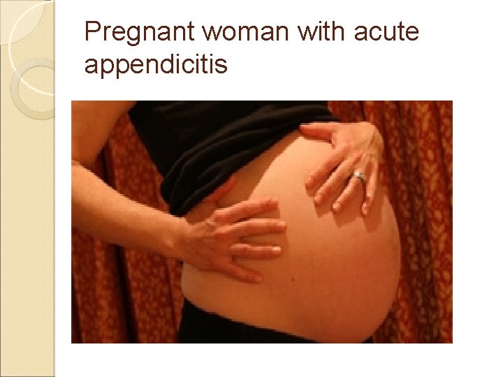 Pregnant woman with acute appendicitis Pregnant woman with acute appendicitis