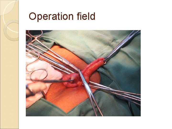 Operation field Operation field