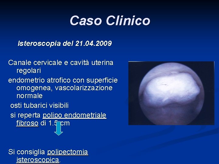 Caso Clinico Isteroscopia del 21. 04. 2009 Canale cervicale e cavità uterina regolari endometrio Caso Clinico Isteroscopia del 21. 04. 2009 Canale cervicale e cavità uterina regolari endometrio