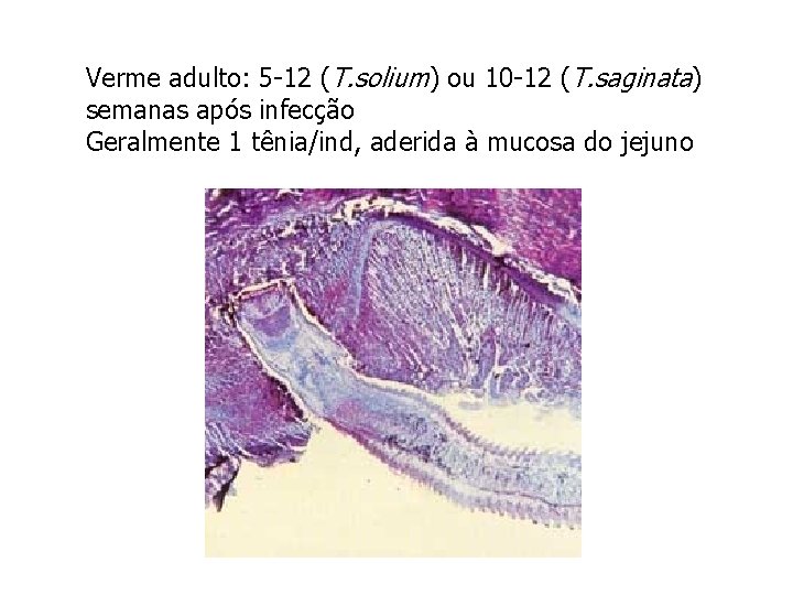 Verme adulto: 5 -12 (T. solium) ou 10 -12 (T. saginata) semanas após infecção