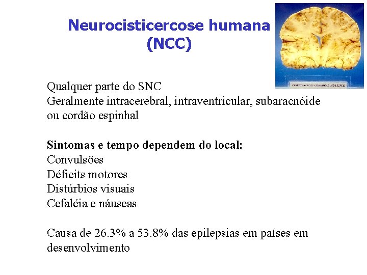 Neurocisticercose humana (NCC) Qualquer parte do SNC Geralmente intracerebral, intraventricular, subaracnóide ou cordão espinhal