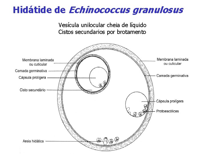 Hidátide de Echinococcus granulosus Vesícula unilocular cheia de líquido Cistos secundarios por brotamento 