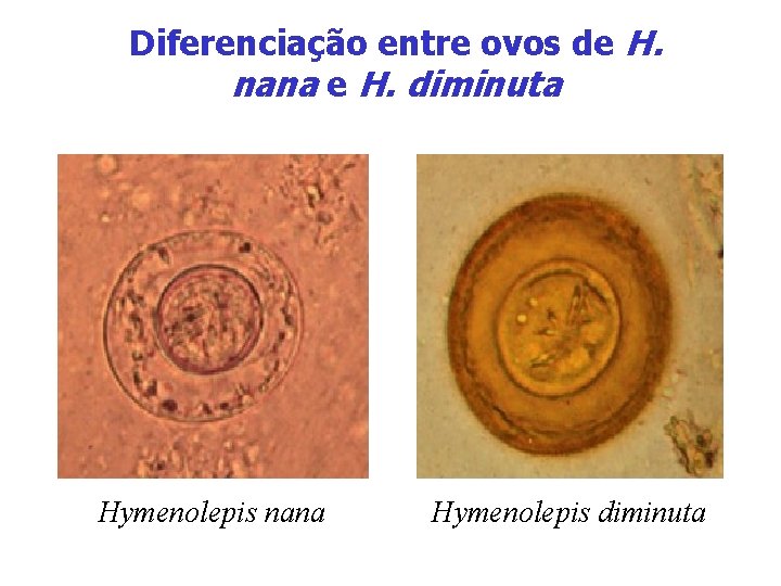 Diferenciação entre ovos de H. nana e H. diminuta Hymenolepis nana Hymenolepis diminuta 