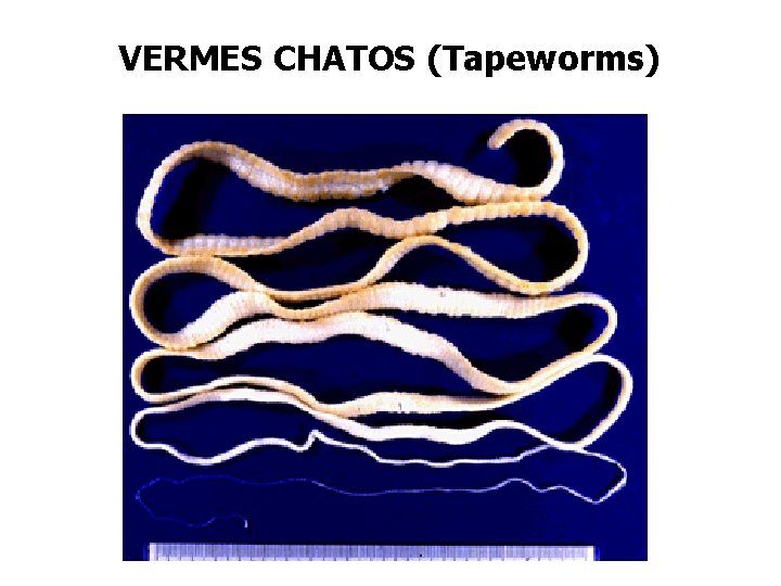 VERMES CHATOS (Tapeworms) 