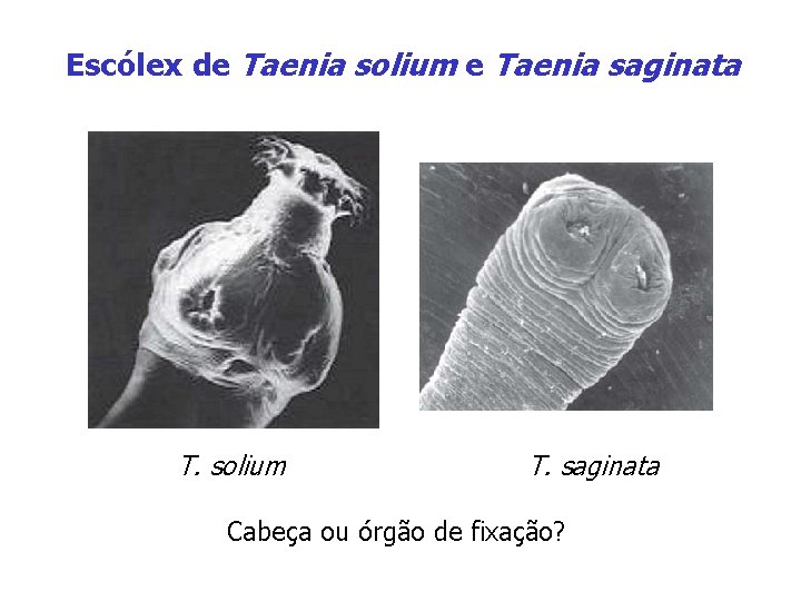 Escólex de Taenia solium e Taenia saginata T. solium T. saginata Cabeça ou órgão