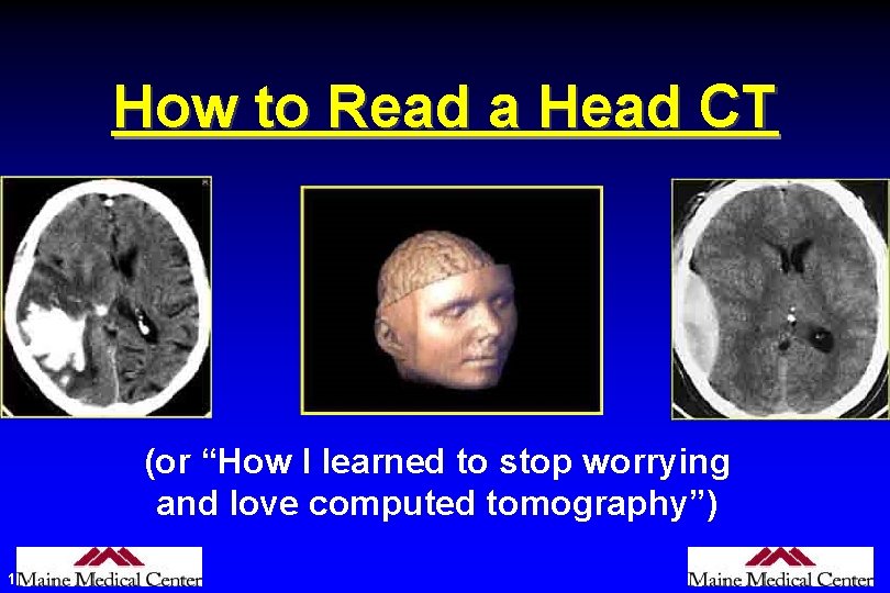 How to Read a Head CT (or “How I learned to stop worrying and