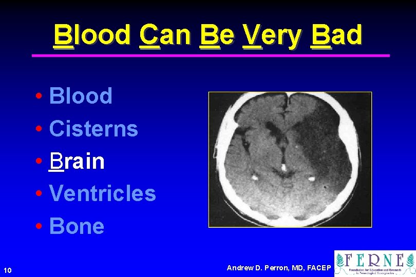 Blood Can Be Very Bad • Blood • Cisterns • Brain • Ventricles •