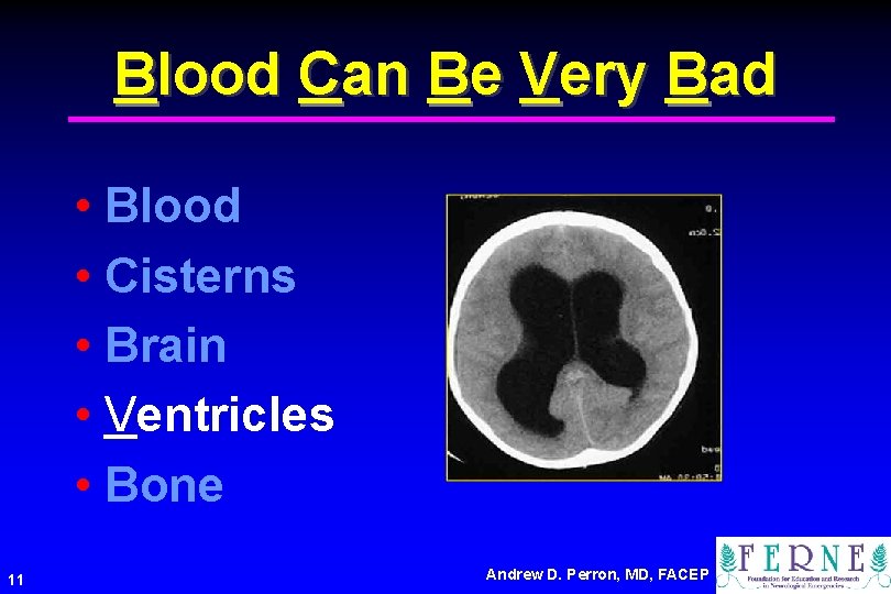 Blood Can Be Very Bad • Blood • Cisterns • Brain • Ventricles •