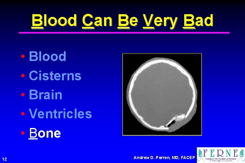 Blood Can Be Very Bad • Blood • Cisterns • Brain • Ventricles •