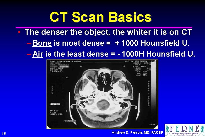 CT Scan Basics • The denser the object, the whiter it is on CT