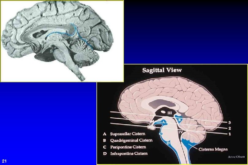 Sagittal View 21 