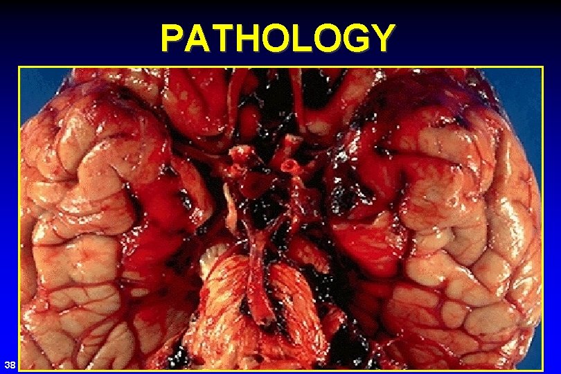 PATHOLOGY 38 