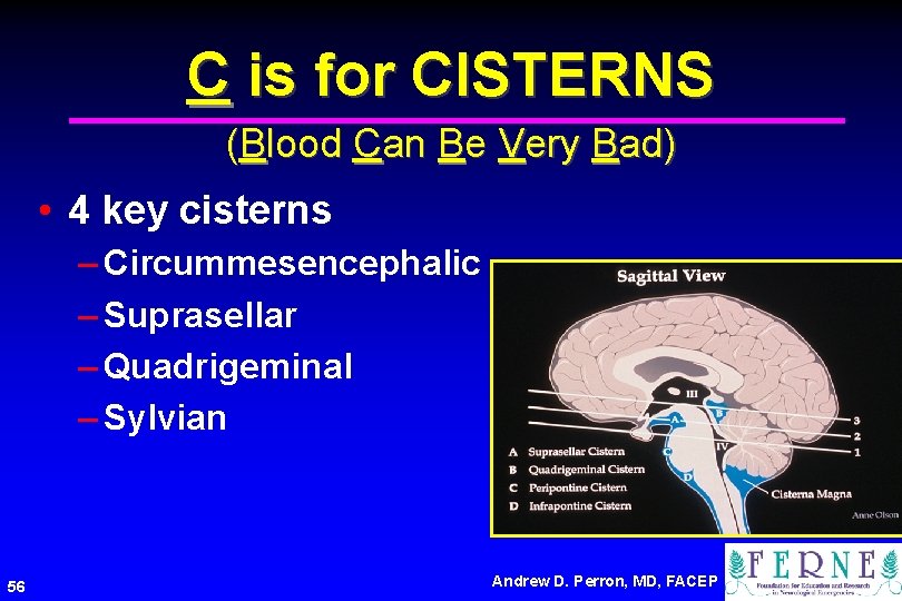 C is for CISTERNS (Blood Can Be Very Bad) • 4 key cisterns –