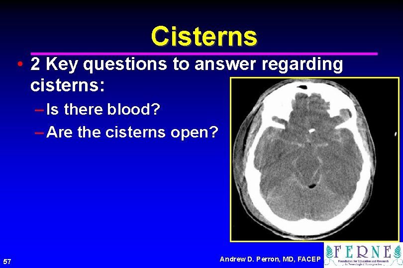 Cisterns • 2 Key questions to answer regarding cisterns: – Is there blood? –