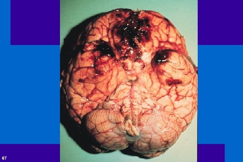 67 Andrew D. Perron, MD, FACEP 