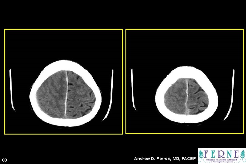 68 Andrew D. Perron, MD, FACEP 