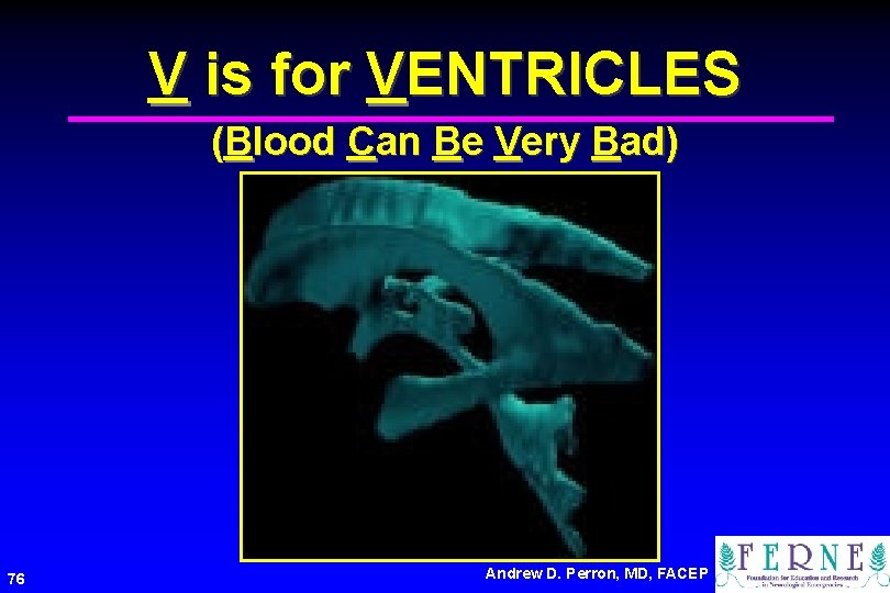V is for VENTRICLES (Blood Can Be Very Bad) 76 Andrew D. Perron, MD,