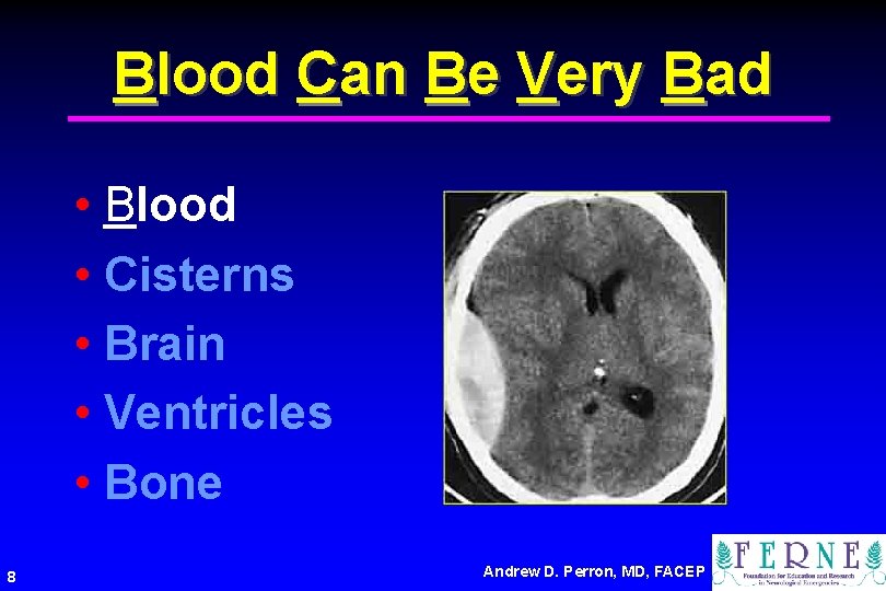 Blood Can Be Very Bad • Blood • Cisterns • Brain • Ventricles •