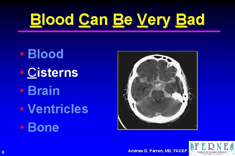 Blood Can Be Very Bad • Blood • Cisterns • Brain • Ventricles •