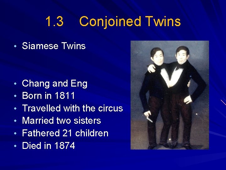 1. 3 Conjoined Twins • Siamese Twins • • • Chang and Eng Born