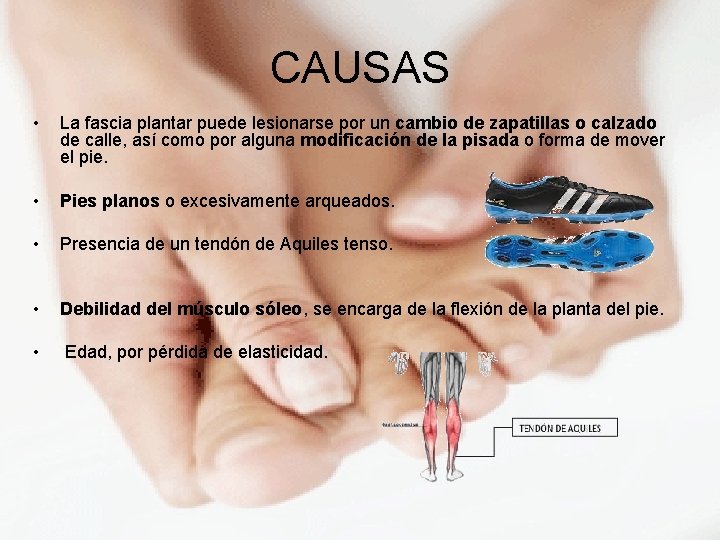 CAUSAS • La fascia plantar puede lesionarse por un cambio de zapatillas o calzado CAUSAS • La fascia plantar puede lesionarse por un cambio de zapatillas o calzado