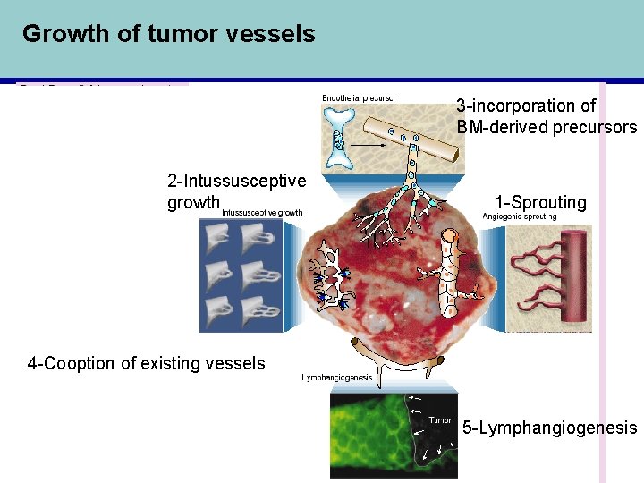 Growth of tumor vessels 3 -incorporation of BM-derived precursors 2 -Intussusceptive growth 1 -Sprouting