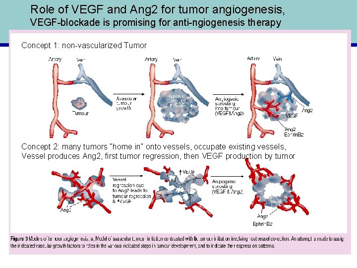 Role of VEGF and Ang 2 for tumor angiogenesis, VEGF-blockade is promising for anti-ngiogenesis